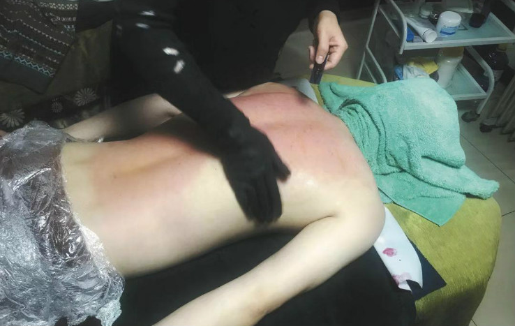 权健火疗馆内,火疗后,店员将权健“火龙液”涂在记者背上。