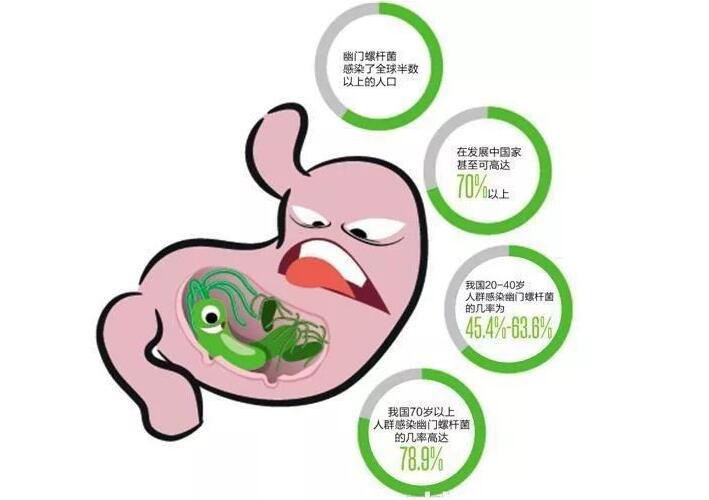 全中国一半人都感染的幽门螺杆菌,到底是怎么