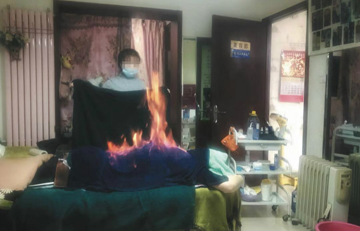 2018 年12 月26 日,北京丰台区方庄某小区内,一家美发店也经营权健火疗,记者体验火疗时,吊灯也被腾起的火焰烧坏。
