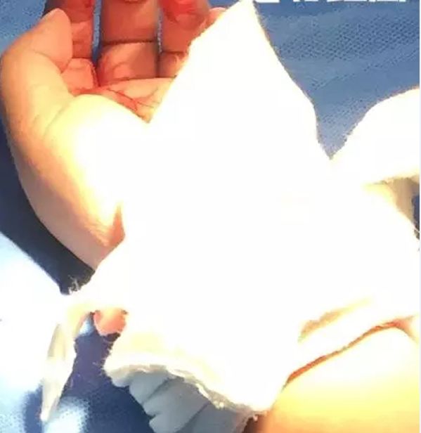 ▲童先生的儿子手部被狗咬伤。图片来源：江苏电视台“南京零距离”。