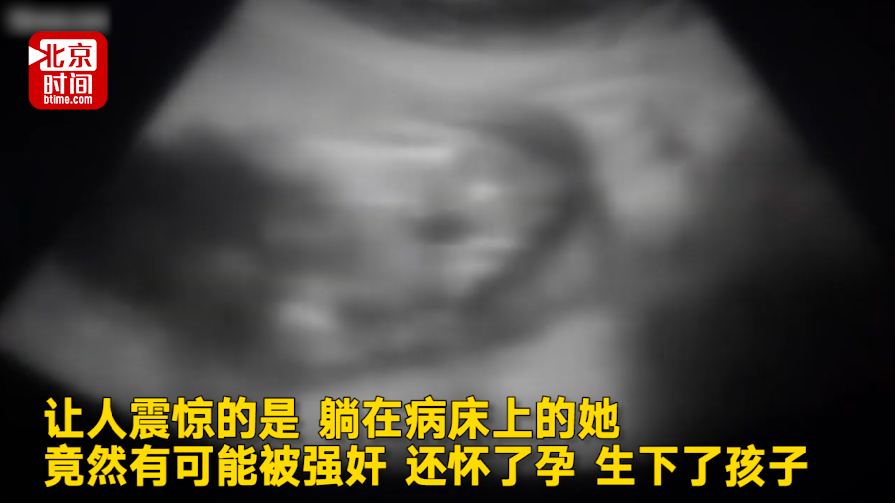 美国女性植物人昏迷10年突然产子 警方:疑似遭