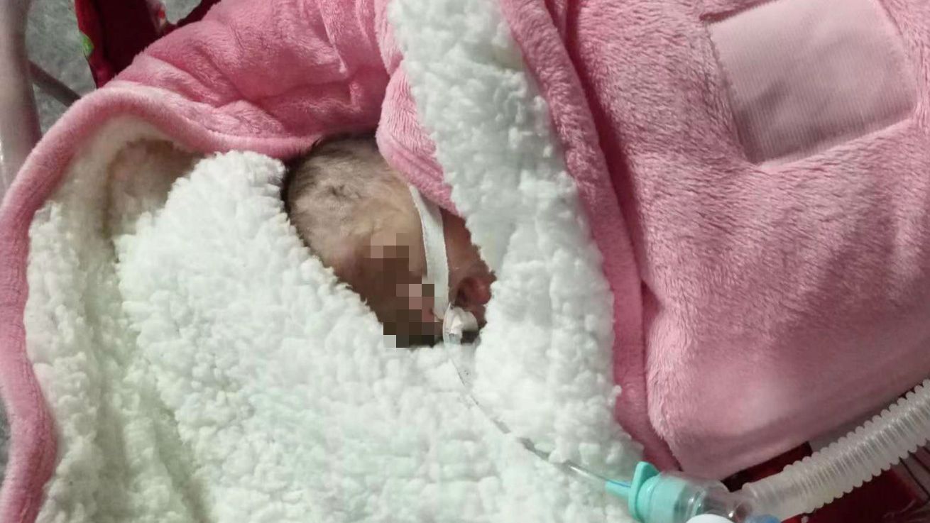 孩子出生后因心臟有雜音，在醫院準備做彩超前拍攝。受訪者供圖