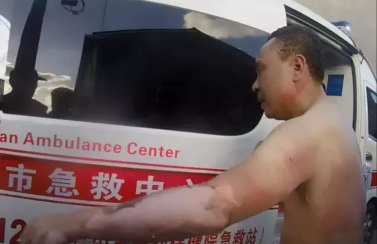 女子自杀点煤气爆燃 警员为保护群众全身6刘仁娜