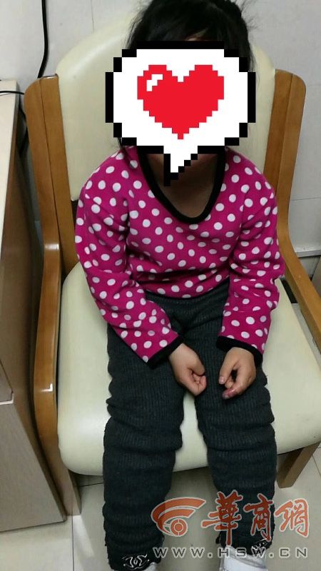 西安4岁女童皮筋套手指睡着 手指缺血性坏死