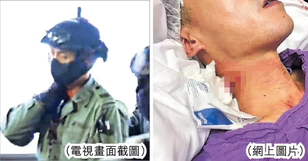  10月13日，一名香港警察在执行任务时遭暴徒割伤颈部  图源：港媒