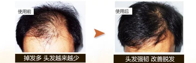 90%的女人都用错了洗发水，难怪头油、脱发！