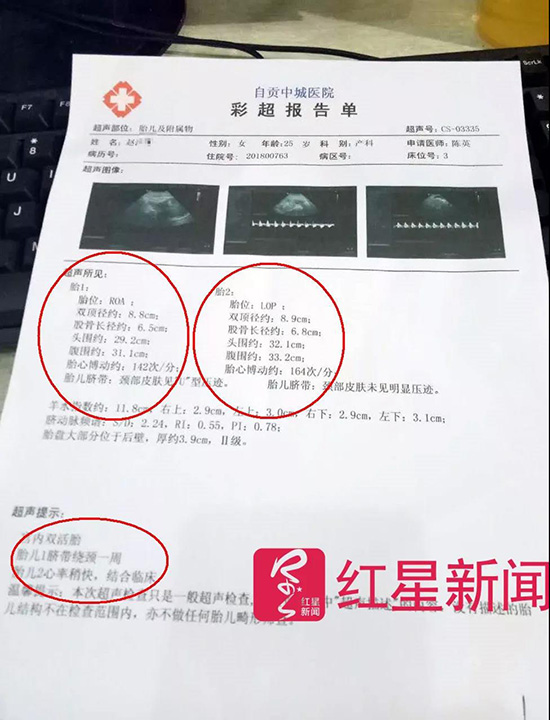 8月22日，赵洋洋在自贡中城医院的术前彩超报告单 受访者供图