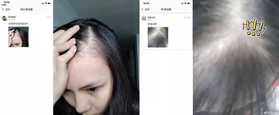 网友晒出脱发照,看得我头皮发麻!细思极恐!