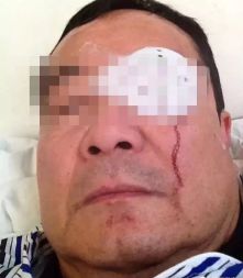 女博士后遭亿万富翁丈夫家暴,起诉离婚要求赔