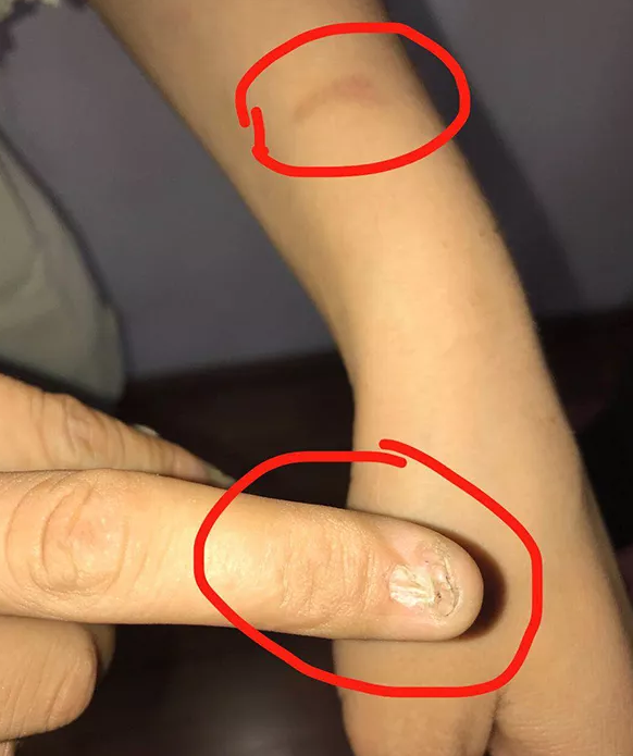 1014岁女孩大衣风衣_14岁少女被骗离乡遭暴打,10年后与男友开房却因此找到家人