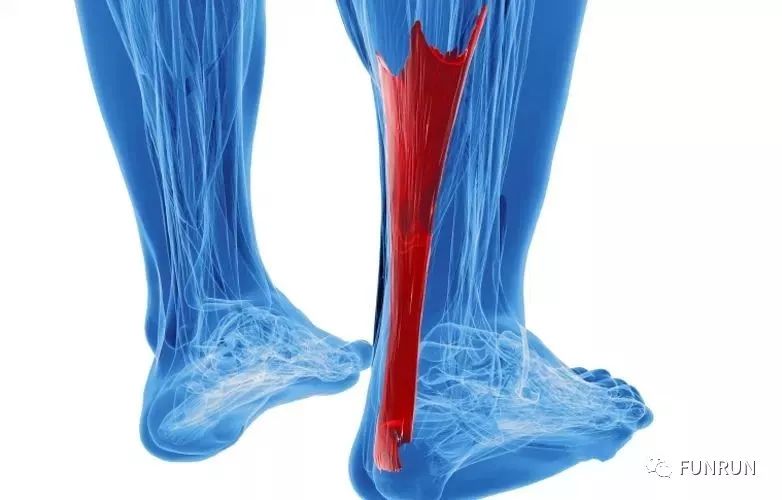 跟腱在哪里？跟腱受伤的主要症状是什么？