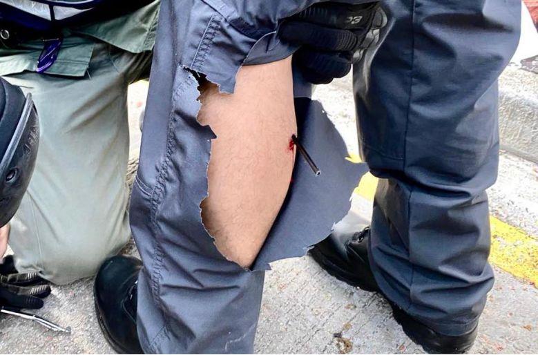 (警察传媒联络队一队员被箭射中小腿,图源:香港警察脸书)