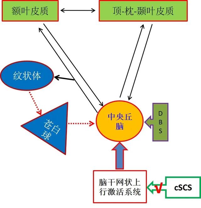 脑深部电刺激促醒长期意识障碍患者