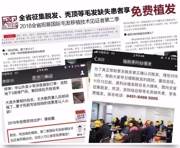 招募毛发缺失者,免费植发|脱发、秃顶、发际线