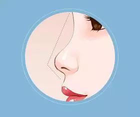 好好的鼻子怎么就变成了“朝天鼻”