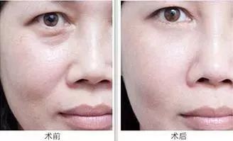 对比