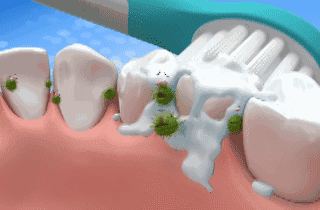 牙黄口臭终结者！每天刷两次，口腔溃疡、牙龈肿痛都不见啦！