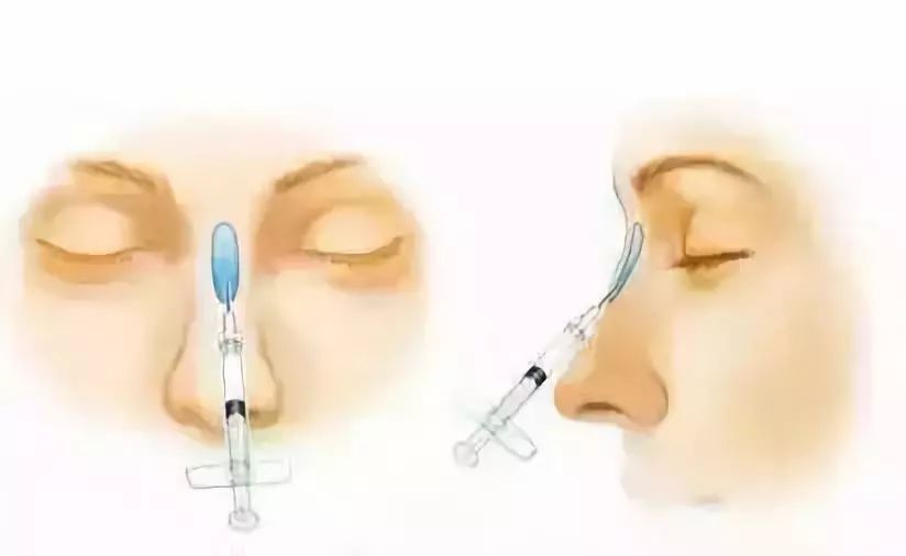 什么样的鼻子才叫好看