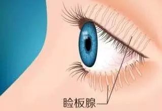 美女做了一条美瞳线后,每天都在遭罪……