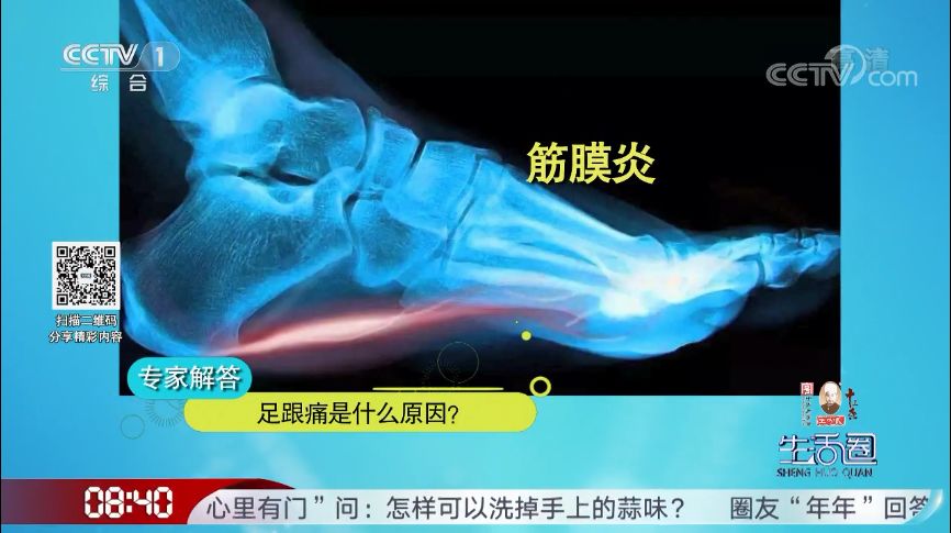记住这几招,轻松缓解!|筋膜炎|脚趾
