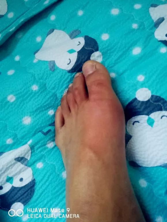 世界杯期间,大连小伙一觉醒来变成石头人!这个