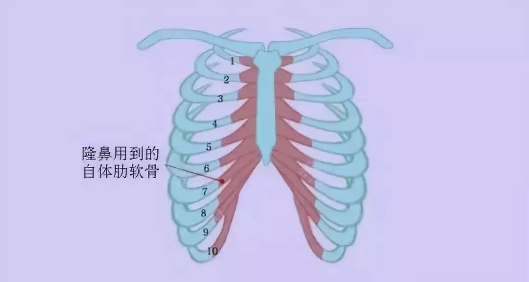 隆鼻用到的肋软骨