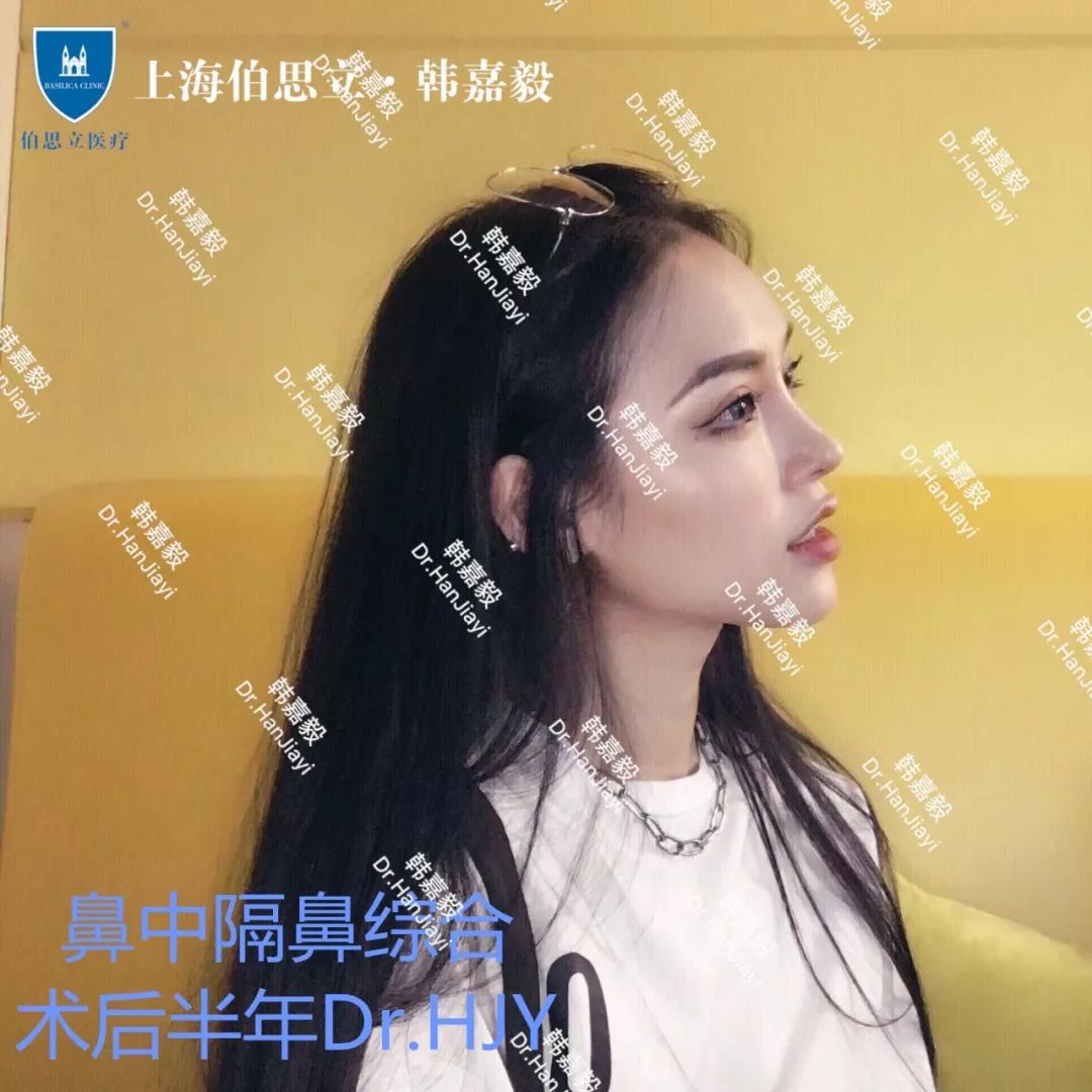 术后