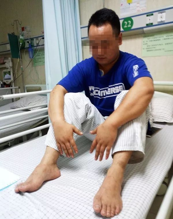 可怕!男子被一群小小的蚂蚁咬后竟失去知觉,最