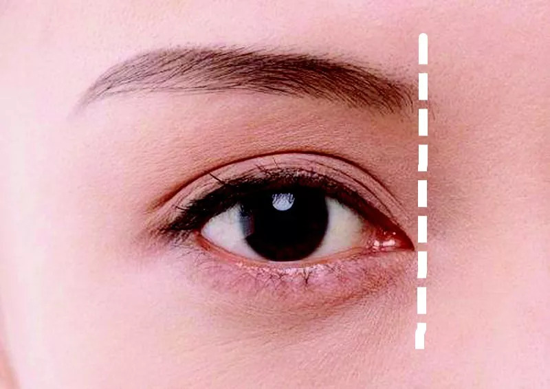 标准眼睛是多少度,标准眼睛是多少度的视力