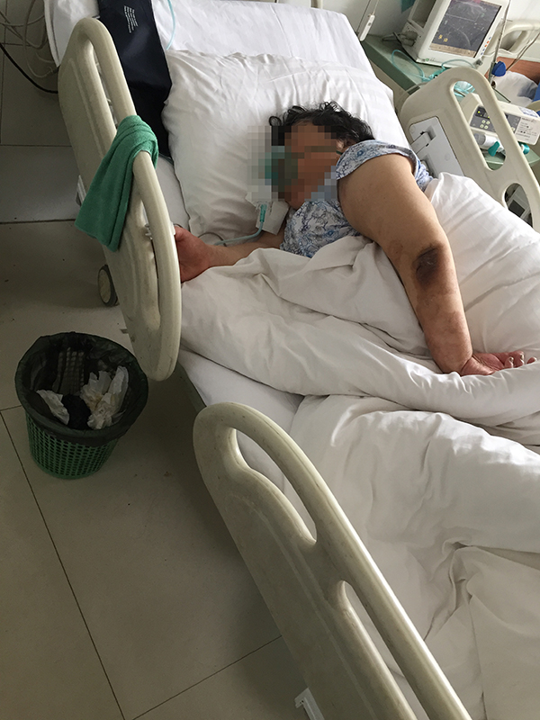 張改玲已經病危昏迷半個月