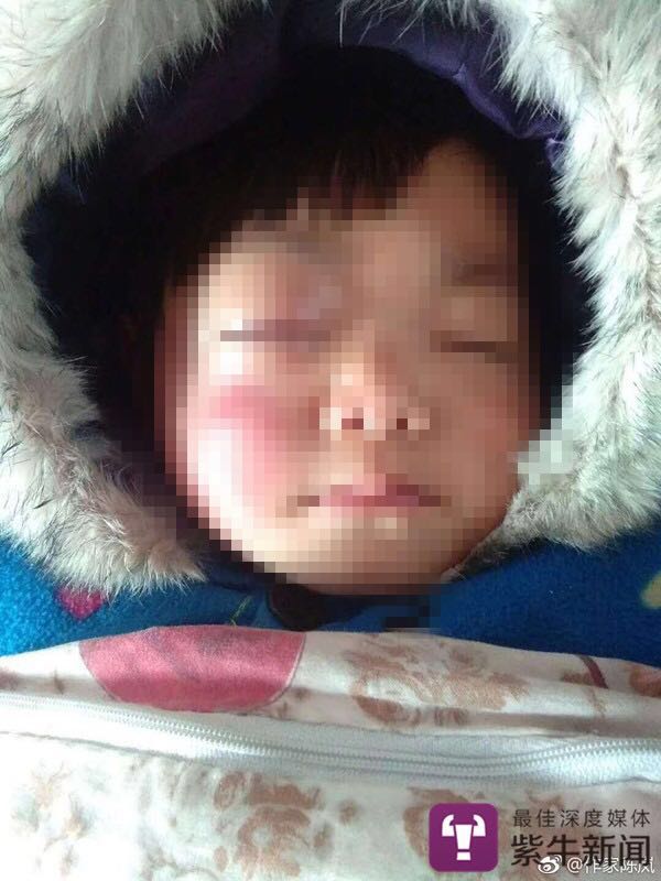 【紫牛新闻】患癌去世女童家人起诉作家陈岚名