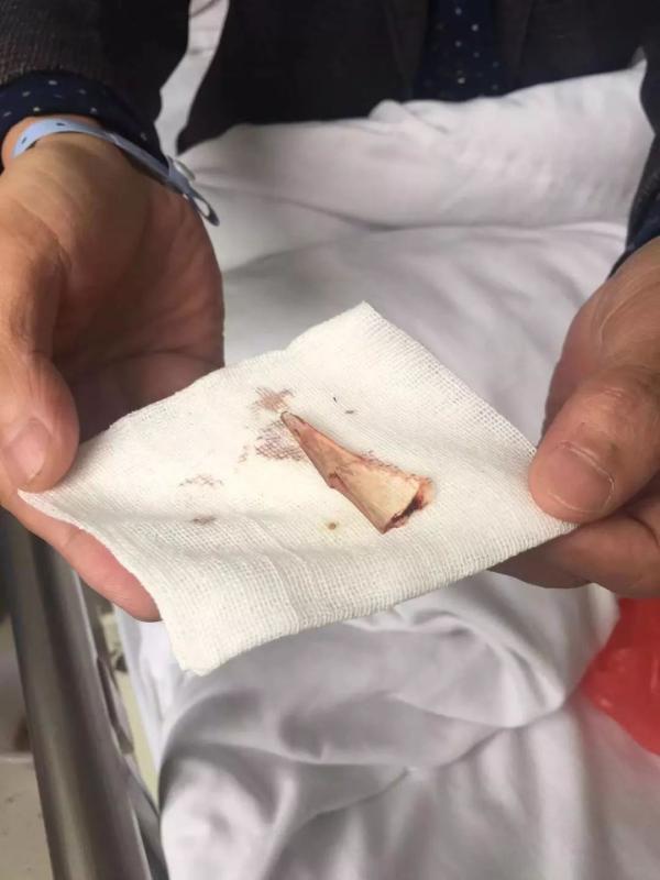 21日下午，记者在枞阳县医院脑外科住院部见到了躺在病床上打着点滴的鲍观祥。