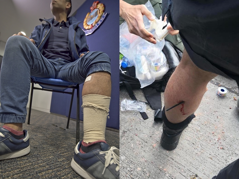 中箭警长:一句支持香港警察 足以推动我再上前