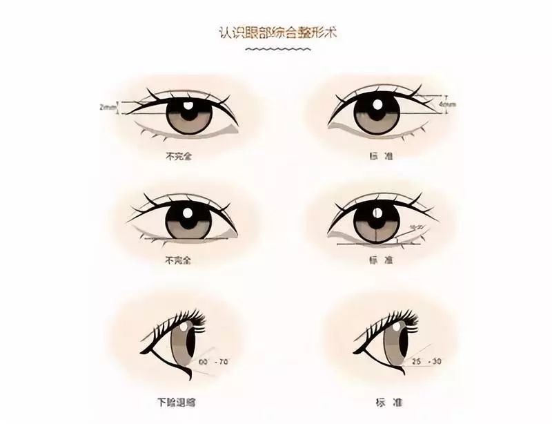 眼睛基弧小怎么办,眼睛基弧小是什么原因