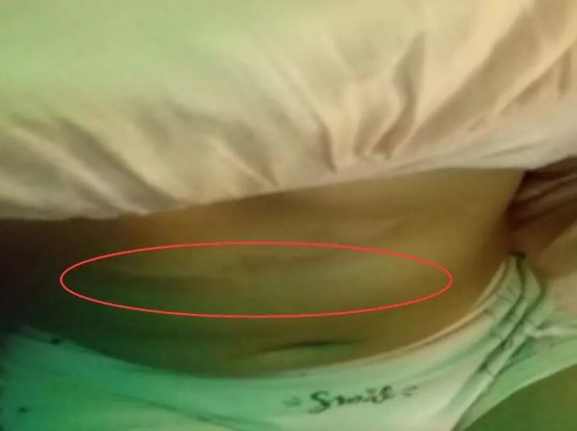 抖音超火的冒烟冰淇淋冻伤柳州5岁女孩!看到-