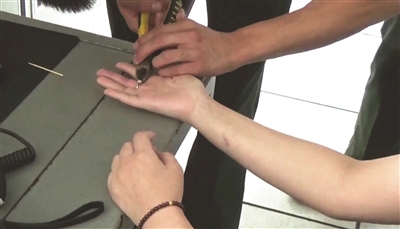 睡觉时戒指莫名换手指 取不下来只好请消防破拆