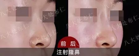 对比