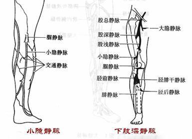 有血栓的人口比例_腿上有血栓真人图片(3)
