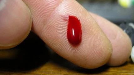 手指割破放进嘴里舔一舔,真的科学吗?