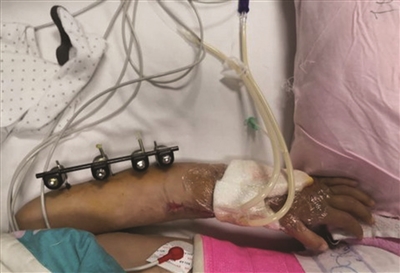 保命?保手?艰难抉择