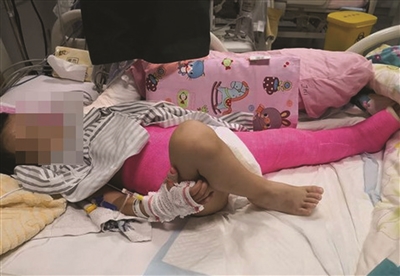 两岁娃断臂，保命还是保手？但这次医生的情感战胜了理智……