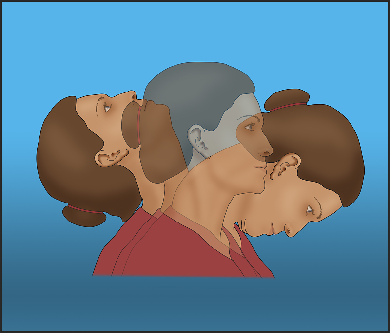 脖子前倾毁气质,明星也逃不过,更严重的是.