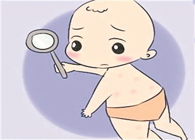 春季疹子即将出动,急疹麻疹水痘怎么防