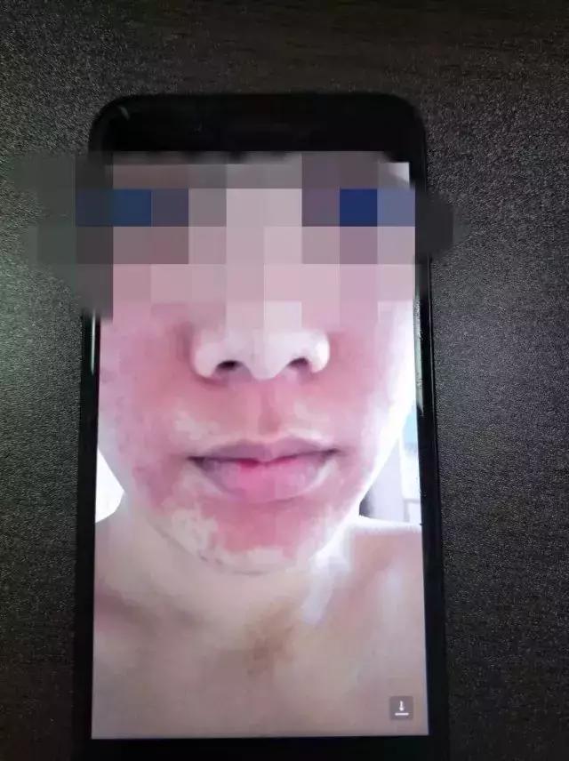美容院卖的这东西千万别买,严重可致死亡!