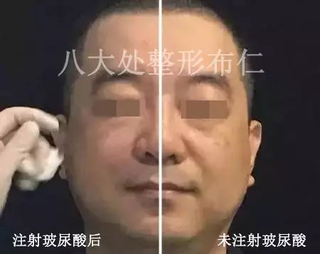 对比