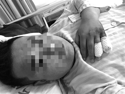 嘀嗒顺风车司机加价被拒砍人 乘客手指被砍断,要在医院过年了