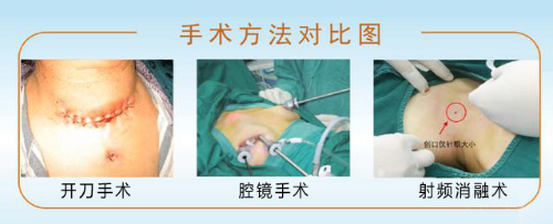 做完甲状腺结节手术,患者笑着走出手术室