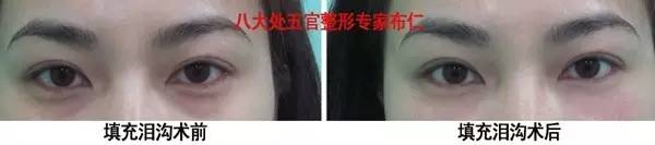 对比
