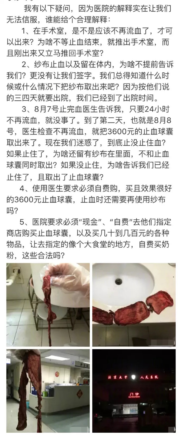 工作失误?北大人民医院医生竟把3块纱布留在