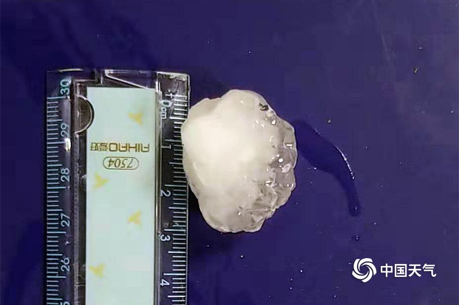 割双眼皮什么梗